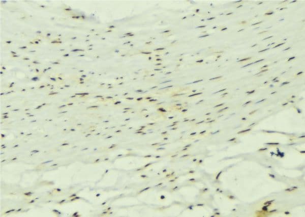 KALRN / KALIRIN Antibody