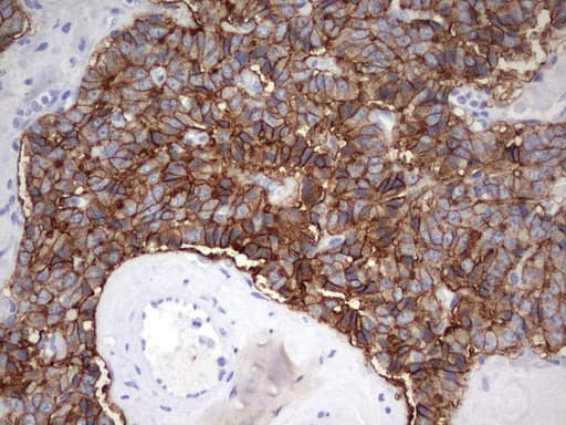 EPCAM Antibody (clone UMAB132, Carrier-free)