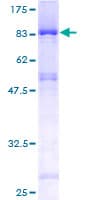 Human EDC3 Protein (Recombinant GST)