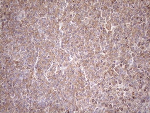 TNFRSF10B / Killer / DR5 Antibody (aa203-411, clone OTI2A5)