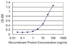 ERBB2 / HER2 Antibody (clone 3B1)