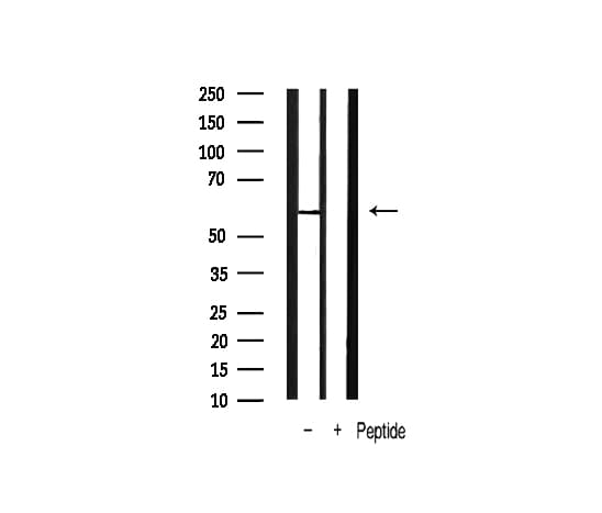 PDPK1 / PDK1 Antibody (phospho-Ser241)