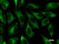 Monoclonal Mouse anti-Human ZW10 Antibody (clone 3363C4a, IF, WB)