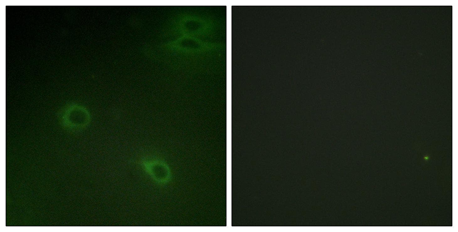 Polyclonal Rabbit anti-Human CXCR4 Antibody (phospho-Ser339, IHC, IF, WB)