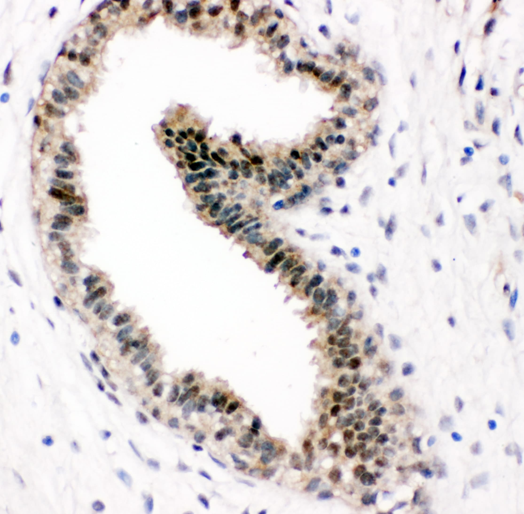 Polyclonal Rabbit anti-Human VCP Antibody (aa749-766, IHC, WB)