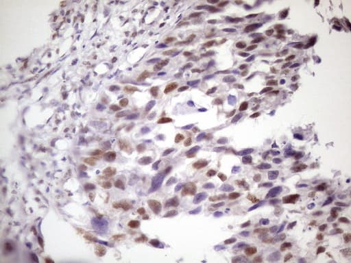 IKBKE / IKKI / IKKE Antibody (aa474-716, clone OTI3C5)