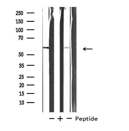 STK33 Antibody
