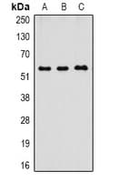 CASP8 / Caspase 8 Antibody