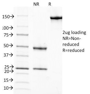 RBP / Retinol Binding Protein Antibody (clone G4E4)