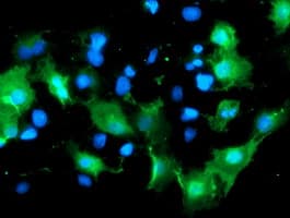 DOK7 Antibody (clone OTI5G8)