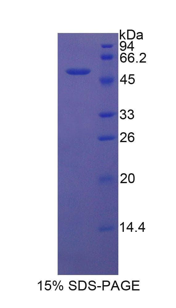 Rat DKK1 Protein (Recombinant His-GST)