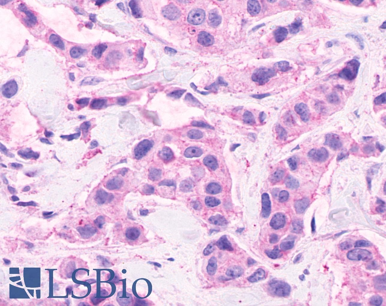 IHC-plus™ CELSR2 Antibody (C-Terminus)