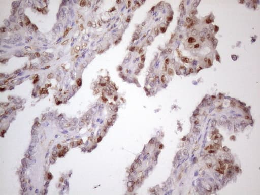 CDKN1A / WAF1 / p21 Antibody (aa2-164, clone OTI5G1)