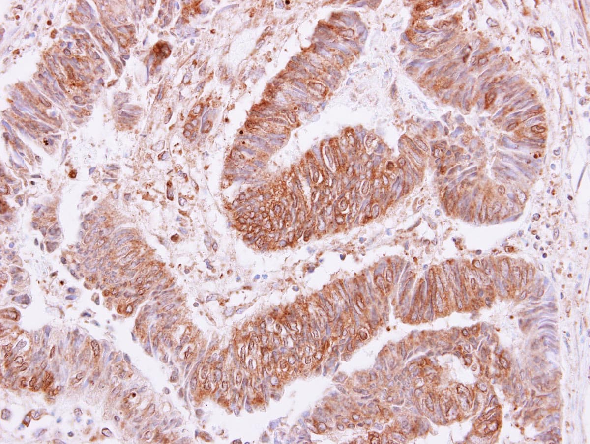 Polyclonal Rabbit anti-Human VPS35 Antibody (aa733-796, IHC, WB)