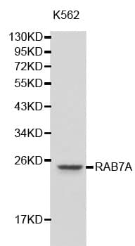 IHC-plus™ RAB7A / RAB7 Antibody