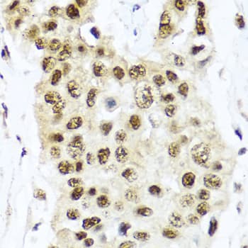 TET2 Antibody