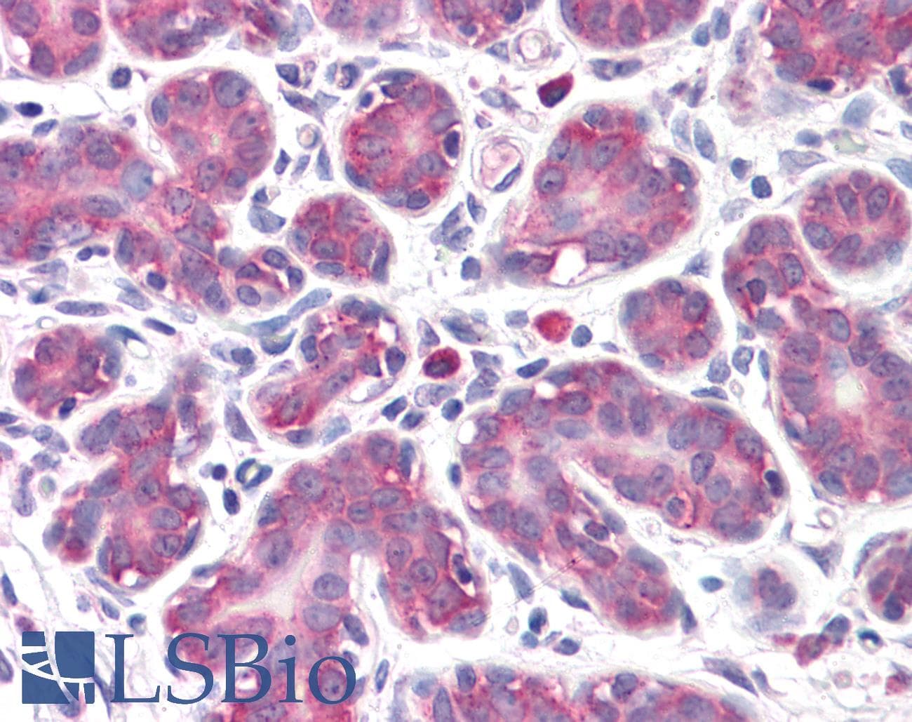 IHC-plus™ Polyclonal Rabbit anti-Human GPR32 Antibody (IHC, WB)