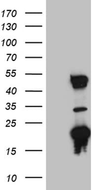 TYW2 / TRMT12 Antibody (clone 5C9)