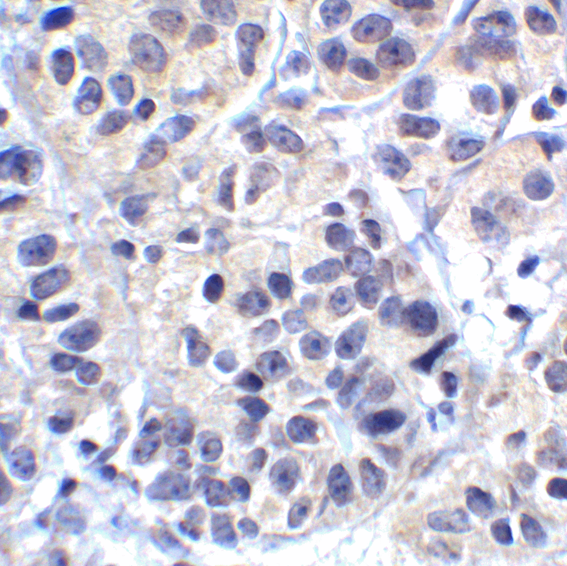 IHC-plus™ VSIR / GI24 / VISTA Antibody (clone 8E11)