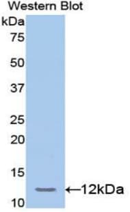 TCF20 Antibody (aa125-213)