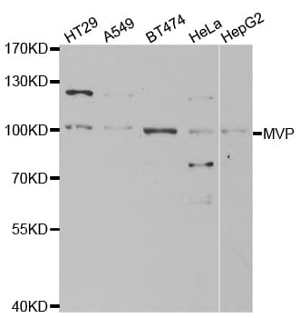 Polyclonal Rabbit anti-Human MVP / VAULT1 Antibody (IHC, WB)