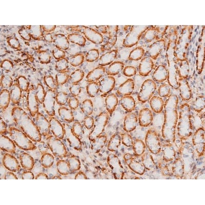 MAPK8 / JNK1 Antibody (phospho-Thr183,pTyr185)