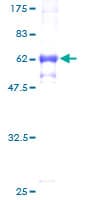 Human K13 / KCNG Protein (Recombinant GST)