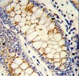 SRSF1 / SF2 Antibody (aa158-186)