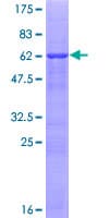 Human HABT1 / ABT1 Protein (Recombinant GST)