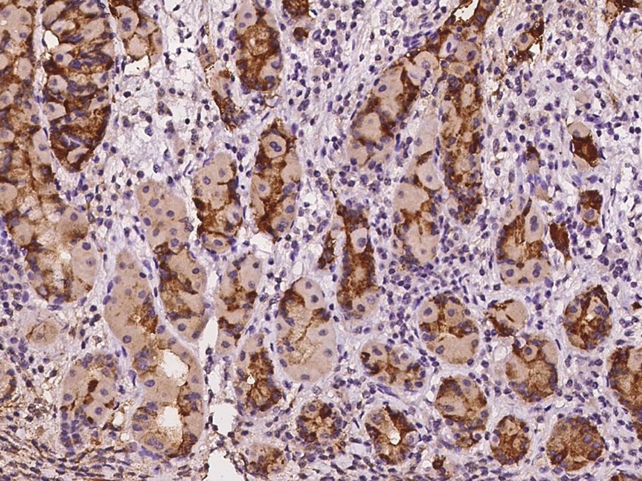 TFF2 / SP Antibody