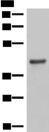 Polyclonal Rabbit anti-Human LMCD1 Antibody (IHC, WB)