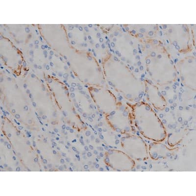 MAPT / Tau Antibody (phospho-Ser356)