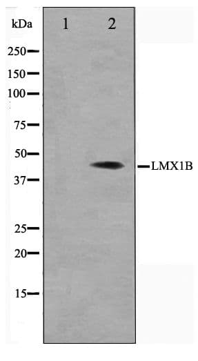 LMX1B Antibody