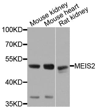Polyclonal Rabbit anti-Human MEIS2 Antibody (WB)