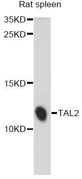 Polyclonal Rabbit anti-Human BHLHA19 / TAL2 Antibody (WB)