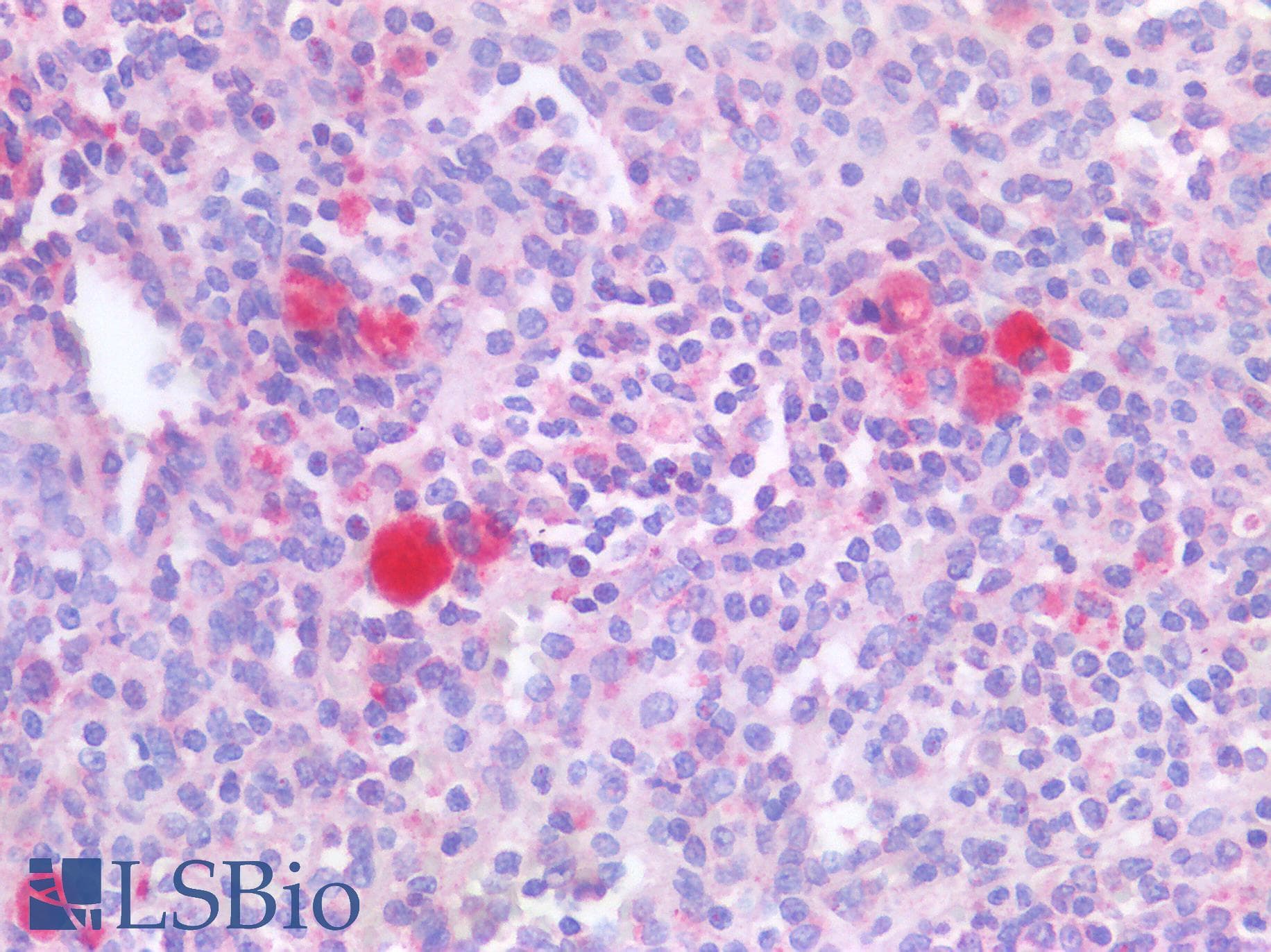 IHC-plus™ CASP3 / Caspase 3 Antibody
