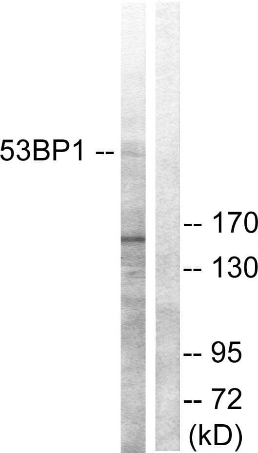 TP53BP1 / 53BP1 Antibody (p6)