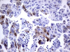 TS / Thymidylate Synthase Antibody (clone OTI5H8, Carrier-free)