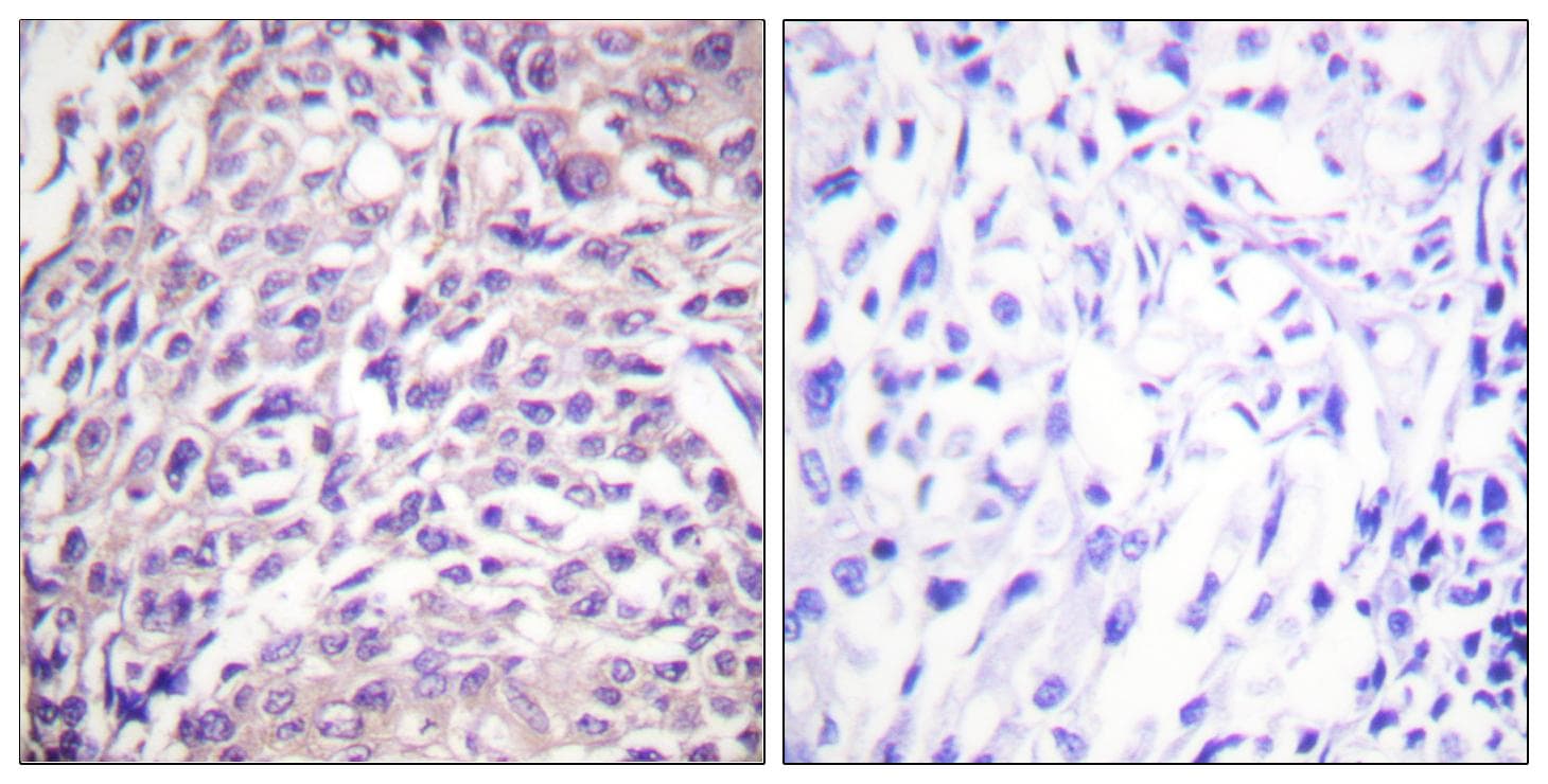 FOXO1 / FKHR Antibody (p329)