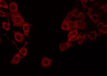 Polyclonal Rabbit anti-Human APOOL / Apolipoprotein O-Like Antibody (IF, WB)