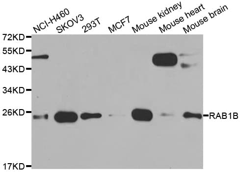 RAB1B Antibody