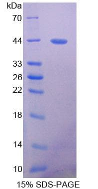 Mouse PRLTS / PDGFRL Protein (Recombinant His-S)