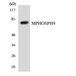 MPHOSPH9 Antibody (aa22-71)