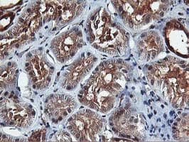 AKT1 Antibody (clone OTI4E10)