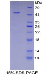Human FETUB / Fetuin B Protein (Recombinant His-GST)