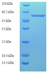 Human Parvovirus B19 VP1 Protein (Recombinant His)