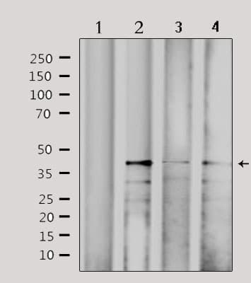 Polyclonal Rabbit anti-Human CBX6 Antibody (IF, WB)