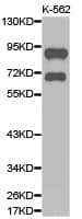 ADRBK2 / GRK3 Antibody