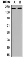 KDR / VEGFR2 / FLK1 Antibody (C-Terminus)