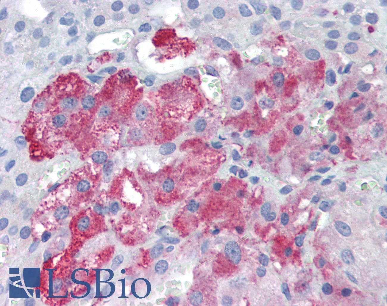 IHC-plus™ PDK4 Antibody (aa382-410)